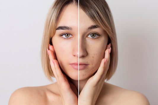 10 Common Skincare Mistakes You Might Be Making (And How to Fix Them)